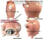 Preview: Sonderver-Bauch-rosaC-202b- Preview: Sonderver-Bauch-rosaC-202b-